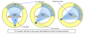 This improved confidence in our understanding of the lifetime cancer risks. Ct Imaging By Elizabeth Swanson Openwetware