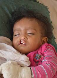 REPAIRING BODIES AND REBUILDING LIVES IN THE ASIA PACIFIC REGION