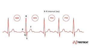Was Ist Die Herzratenvariabilitat Hrv Und Wieso Ist Sie Wichtig Firstbeat