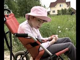 Image result for spastic cerebral palsy images