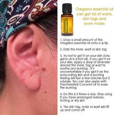 Mole Skin Tag Removal Essential Oil Skin Care Oregano Essential Oil Skin Tags Essential Oils