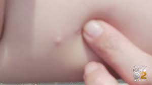 How much does it cost? Woman Charged For Allegedly Taking 12 Year Old Girl To Get Birth Control Implant Against Her Will Cbs Pittsburgh