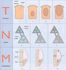 The Awkward Geek B2007 What S Tumour Staging Tumor Staging Cancer Cancer Stages