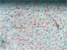 Image result for Caloncoba