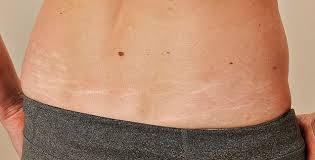 Pin On Skin Care