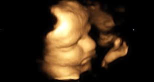 Wie der berufsverband der frauenärzte mitteilt, soll mit dem sogenannten babykino. Ultraschall Als Babyfernsehen Wird Ab 2021 Verboten