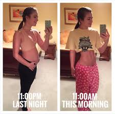 13 Women Showing Their Bloated Bellies To Prove Extreme Bloating Is Totally Normal Bloated Belly Extreme Bloating Bloated Tummy