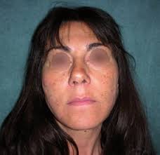 Cirugia plastica revista tapa 20071206:Tapa 1.qxd