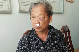 Bắt đối tượng hành hung nhà báo VTV