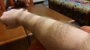 Comment se débarrasser des poils de bras? Rayures Poils Bras