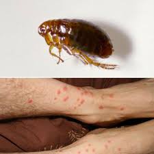 Offrez gratuitement la lecture de cet article à un proche : Piqure D Araignee Photos Allergie Et Les Bons Reflexes A Adopter Doctissimo