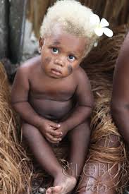 I suspect it is something to do with having an irish descent father and an anglo saxon mother. Facinating Black Skin Blue Eyes And Blonde Hair Black And Blonde Beautiful Children My Black Is Beautiful