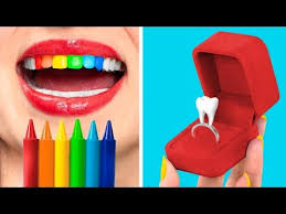 When You Re Friends With A Dentist 19 Funny Situations Youtube In 2020 5 Minute Crafts Videos Dentist Diy Table Runner Wedding