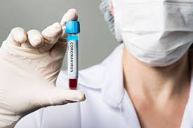 Sdat Test Na Antitela K Koronavirususu V Spb Platno Evromed