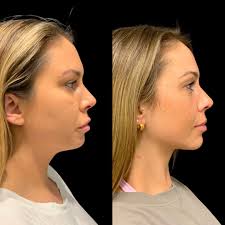 Amanda, you rock! 😎 When Amanda came to us initially, she was