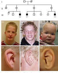Figure 1 From A Novel Mutation In Med 12 Causes Fg Syndrome Opitz Kaveggia Syndrome Semantic Scholar