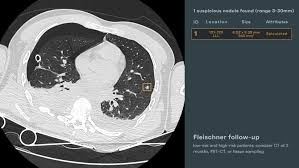 Image result for Incidental Imaging Finding