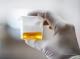 Urine Hcg Level Test Purpose Procedure And Risks