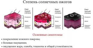 Chem Lechit Solnechnyj Ozhog