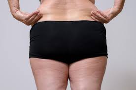 Going commando can cause camel toe so try to avoid doing so when possible. How To Get Rid Of Lower Back Fat