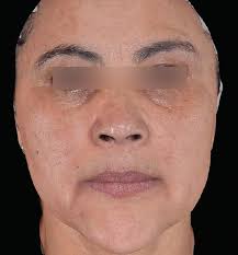 PRIME May/June 2025 by IM-Aesthetics