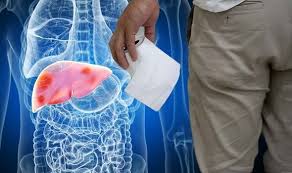 Image result for acholic stools human