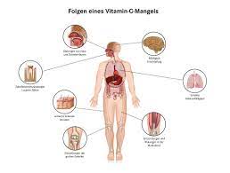 Vitamin C Mangel Pascoe Naturmedizin