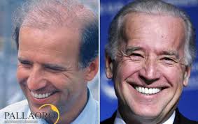 Matthew mcconaughey, kevin costner, robbie williams e john travolta. Trapianto Capelli Vip Autotrapianto Capelli Delle Celebrita Clinica Pallaoro