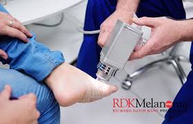 What does skin cancer look like? Skin Cancer Can Hide As Spot On Sole What Does Foot Melanoma Look Like Rdk Melanoma Foundation