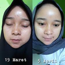 We did not find results for: Theraskin Skincare Suncare With Brightening Digunakan Untuk Melindungi Wajah Dari Paparan Sinar Matahari Dan Membantu Membuat Kulit Wajah Tampak Review Female Daily