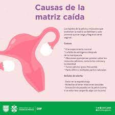 El Prolapso Uterino Tambien Dif Ciudad De Mexico Facebook