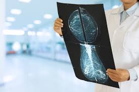Change in breast size and shape. Hormone Replacement Therapy Is Now See As Safe And Helpful For Women Dealing With Menopause The Washington Post