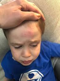 He's got a safety helmet, he's probably ok