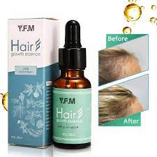 Although it is much feared by women, it is a passage through which we will all pass. Amazon Com Hair Growth Serum Y F M Herbal Hair Growth Essence Hair Loss Prevention Treatment For Men Women With Thinning Hair Stimulate Hair Follicles Strengthens Hair Roots And Help Regrow