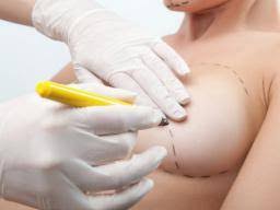 In general, it can take months for the patient to see the final results of breast augmentation surgery. Breast Augmentation What You Need To Know