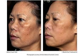 Ryan Sato's Instagram, Twitter & Facebook