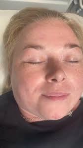 𝐋𝐔𝐌𝐈-𝐏𝐑𝐎 𝐒𝐊𝐈𝐍 𝐁𝐎𝐎𝐒𝐓𝐄𝐑 ⬇️⬇️⬇️Deep cleanse facial with  black head extraction Followed by miroc needling then amazing lumi-pro This  state of the art skin hydrating treatment that delivers intense ...