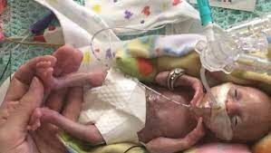 The fetus's skin is still at almost 7 weeks, the fetus's skin appears visibly thickened and substantial compared to previous fetal and embryonic kitten images pictured so far. Earliest Premature Baby Ever Delivered Is Now A Toddler