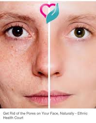 Get Rid Of The Pores On Your Face Naturally Verzorging Gezicht Natuurlijke Verzorgingsproducten Gezondheid En Schoonheid