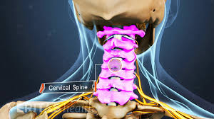 16 bones of the neck cervical vertebrae. All About Neck Pain