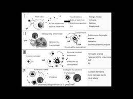 Hypersensitivity Reactions Disorders Types 1 2 3 4 Youtube Hypersensitivity Reactions Hypersensitivity Disorders