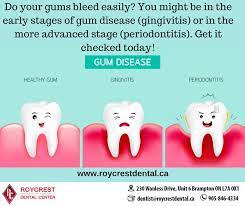 Pin On Dental Information