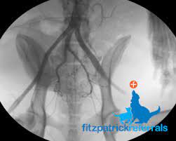 It is particularly exciting that we have such a high success. Prostate Cancer Fitzpatrick Referrals