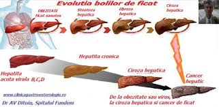 Virusurile sunt agenți patogeni care supraviețuiesc și se multiplică doar în interiorul. Tratamentul Hepatitei C Cabinet De Gastroenterologie Si Hepatologie Bucuresti 0758 751 841 Cabinet De Gastroenterologie Si Hepatologie Bucuresti 0758 751 841