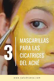 3 Mascarillas De Curcuma Para Quitar Las Cicatrices Del Acne Eliminar Cicatrices De Acne Como Quitar Cicatrices Quitar Cicatrices De Acne