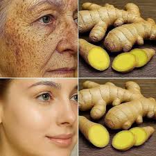 Discover the Power of Ginger for Glowing Skin