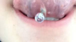 Zungenpiercing Eitert Ist Entzundet Wie Gehe Ich Vor Piercing Piercingpflege