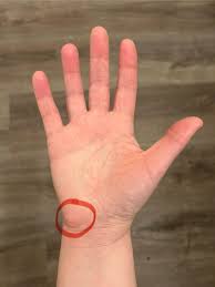 Image result for Pisiform Bone