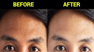 I've certainly used it on my own clients, and i remember it making a huge difference for one client in particular. How Japanese Korugi Massage Will Remove Years From Your Face