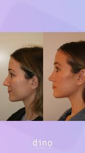 Q: Who would you trust to do your facial plastic surgery? ⁠ A: I would  trust my mentor, Dr. Timothy Marten, if I needed to get any facial  procedure done.